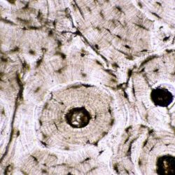 On the photomicrograph of bone below